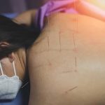 Common Physiotherapy Treatments for Chronic Pain Conditions