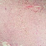 Top Questions to Ask Your Gastroenterologist During a Visit